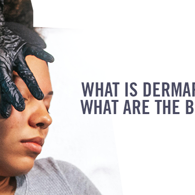 What is Dermaplaning? What Are the Benefits?